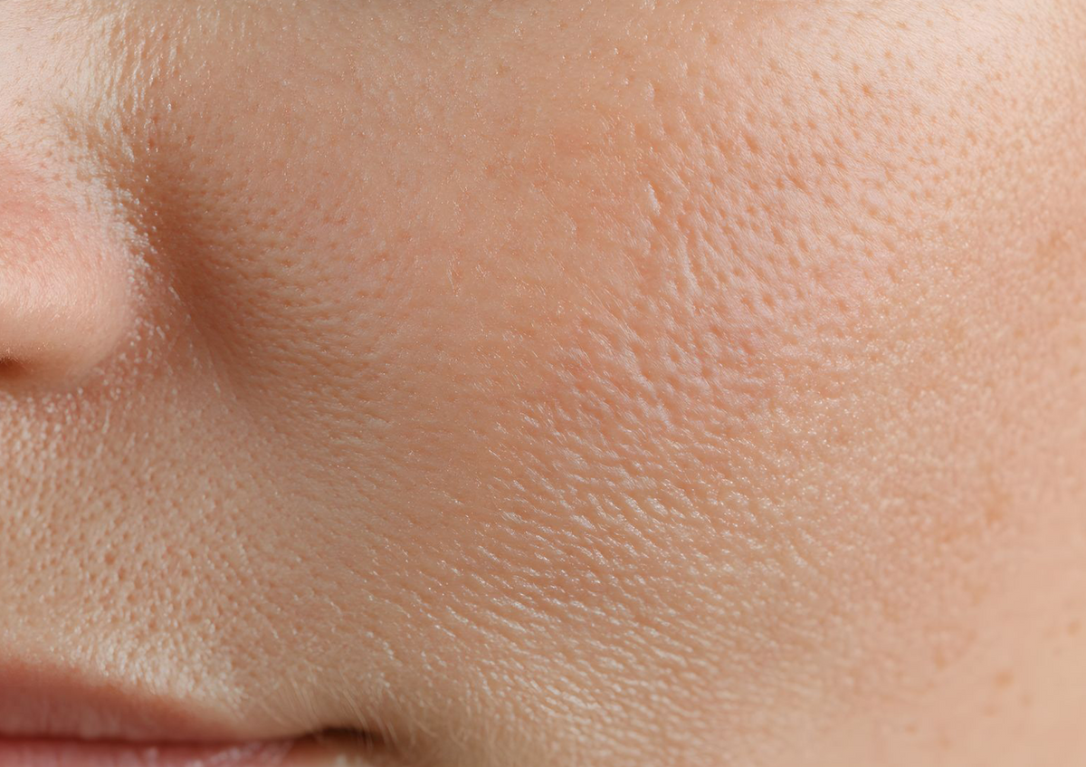 Pourquoi le froid fragilise la peau en hiver ?