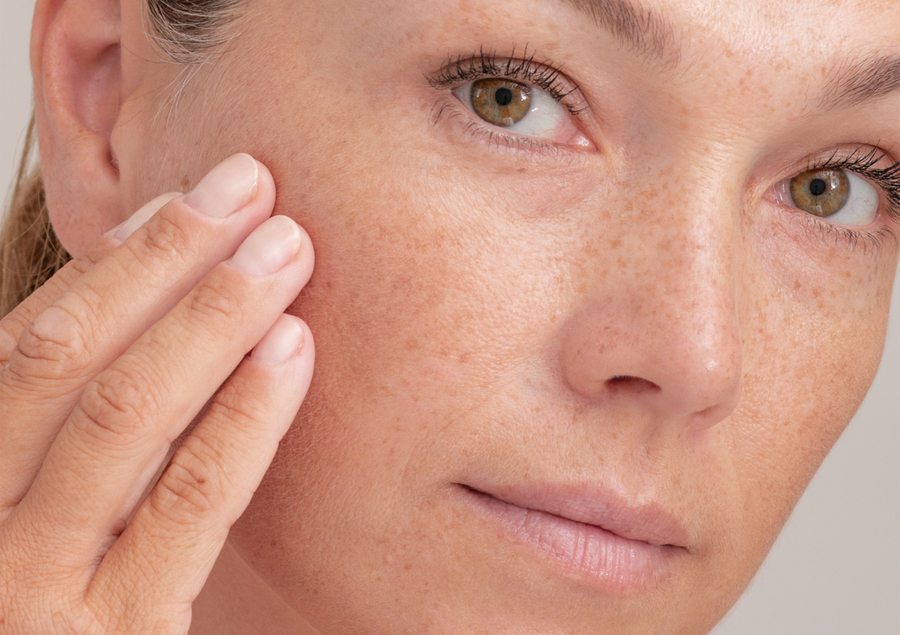 Resserrer les pores du visage : comment faire ?